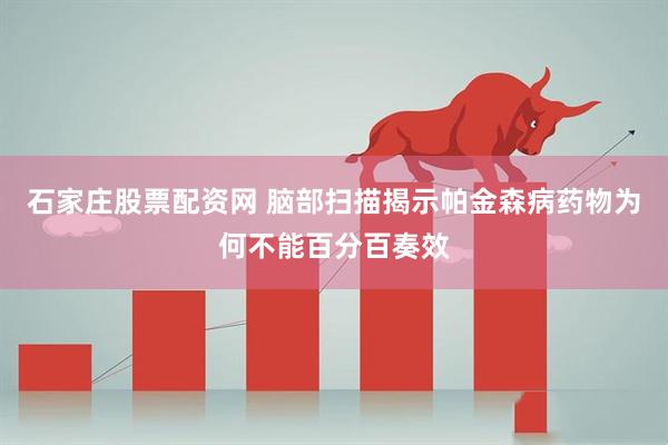 石家庄股票配资网 脑部扫描揭示帕金森病药物为何不能百分百奏效